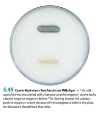 casein hydrolysis test|Lab 5.